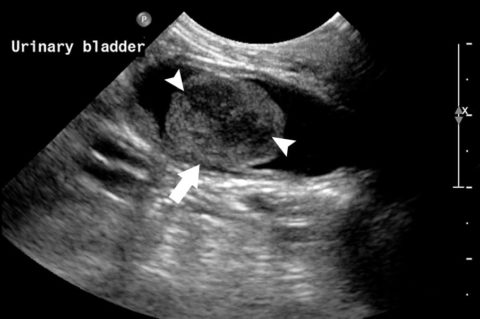 Ultrasound of dog's bladder showing bladder stone